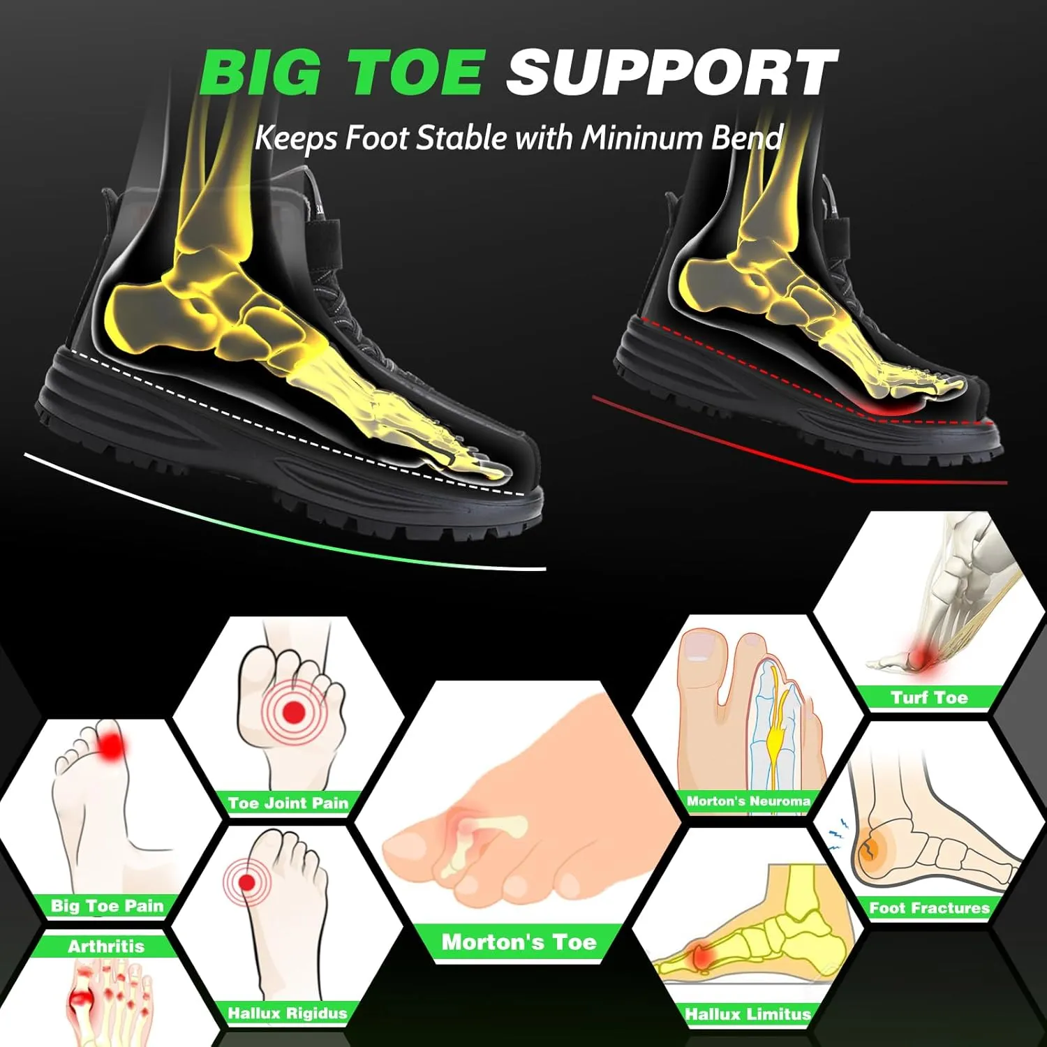 Morton's Extension Orthotic, Carbon Fiber Insole (1 Piece), Rigid Foot Support Insert for Morton's Toe, Foot Fractures, Turf Toe, Hallux Rigidus, and Arthritis, 295(W 13.5-14,M 12.5-13)